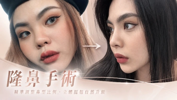 隆鼻手術
