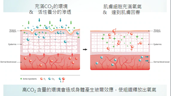 OxyGeneo活氧泡泡電波療程補充圖 1